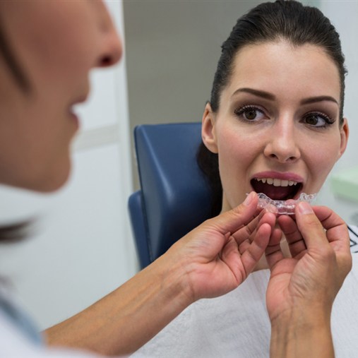 Active Aligners | Cleansmile