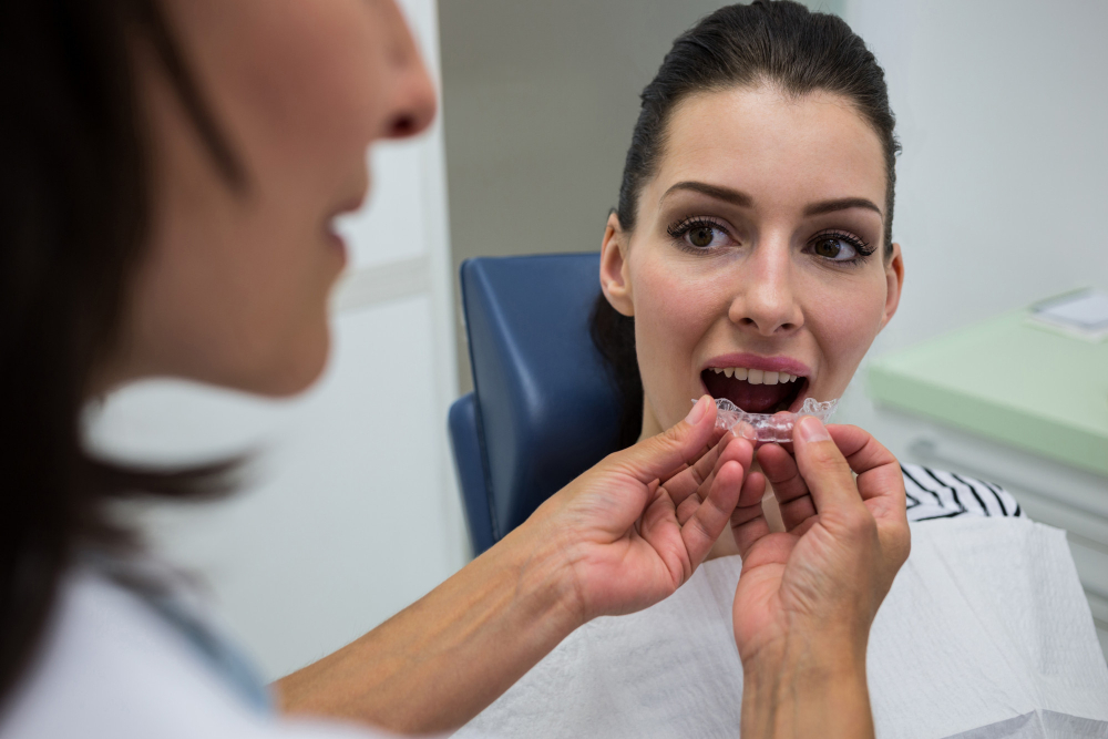 Active Aligners | Cleansmile