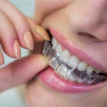 Active Aligners Germiston