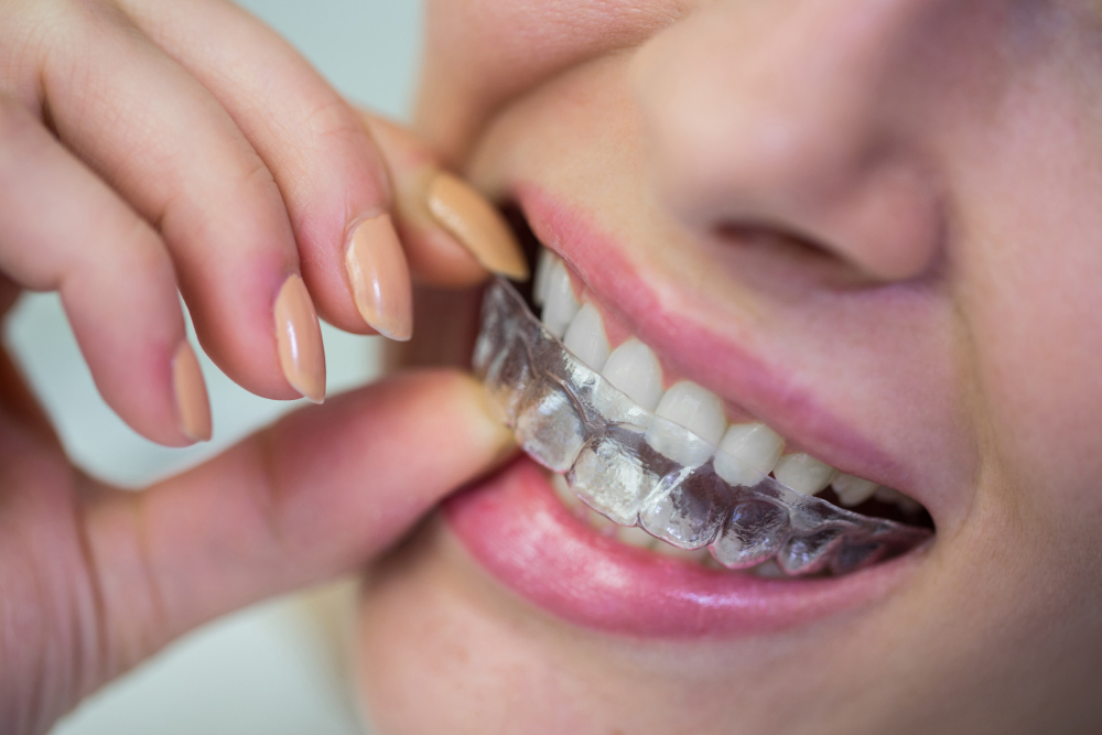 Active Aligners Germiston