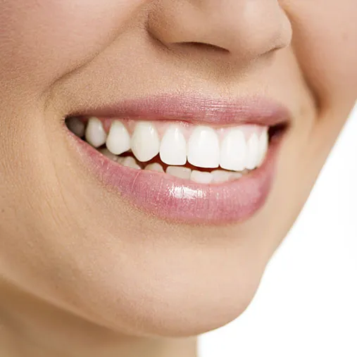 Teeth Whitening Germiston | Cleansmile